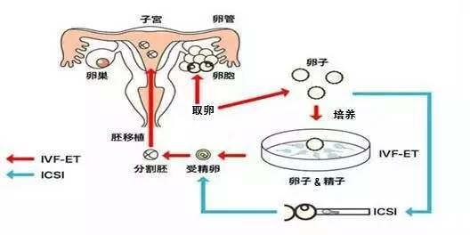 丹东哪里有捐卵机构